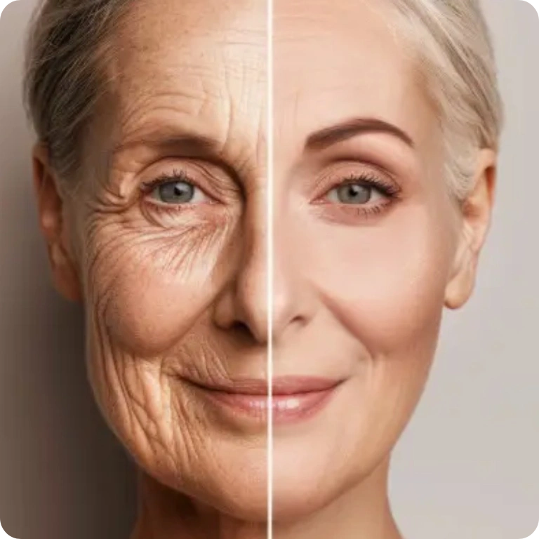 Before and after results of Miami PRP facial injections show reduced signs of aging including smooth skin, fewer wrinkles and fine lines. Reach out to Miami Stem Cell today to discover why we are the top clinic for PRP (vampire) facials in Miami, Florida.